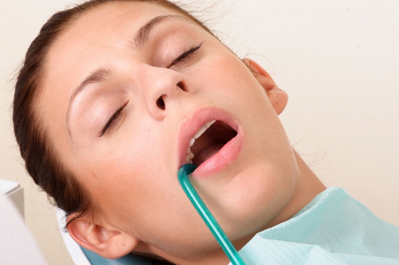 Лечение зубов под наркозом осложнения thumbnail